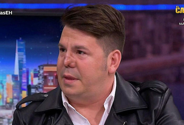 El gran drama de Andy, de Andy y Lucas, por culpa de su nariz: los peores momentos que ha vivido