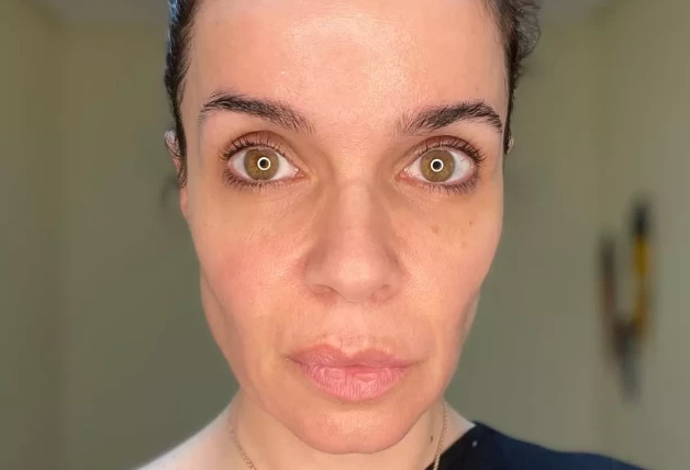 Carme Chaparro enfermedad 1