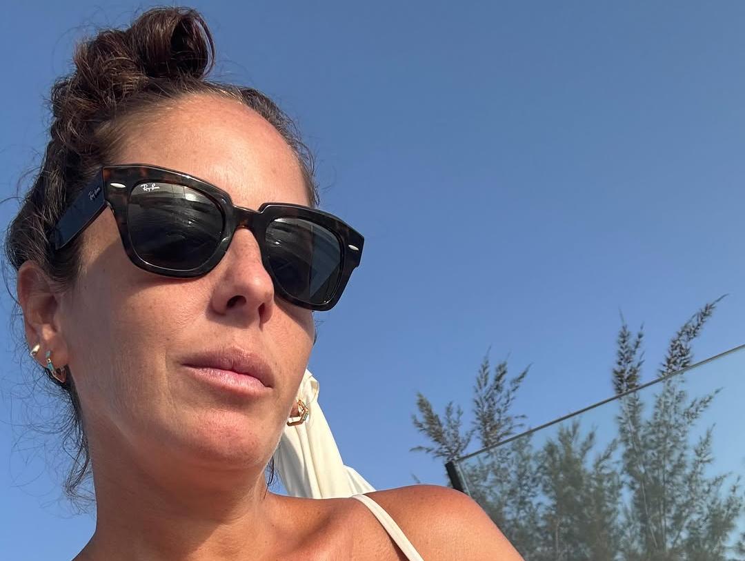 Anabel Pantoja sufre impactantes quemaduras por 2 motivos diferentes