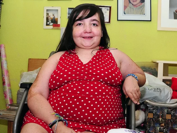 Vanessa, la "niña de los huesos de cristal".
