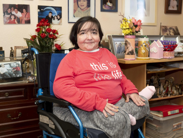 Vanessa Jiménez, la "niña de los huesos de cristal".