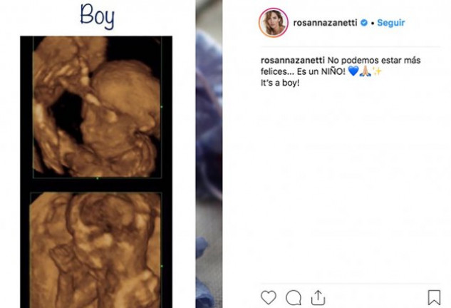 Rosanna y Bisbal han compartido una nueva ecografía de su peque