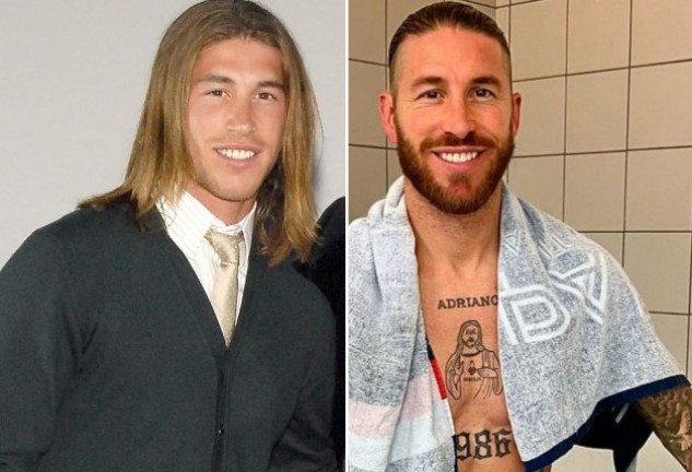 Sergio Ramos, antes y después de sus operaciones estéticas.