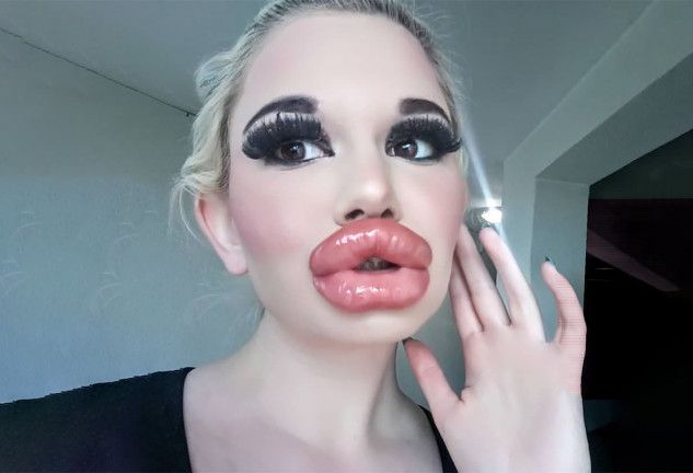 Mujer labios operados