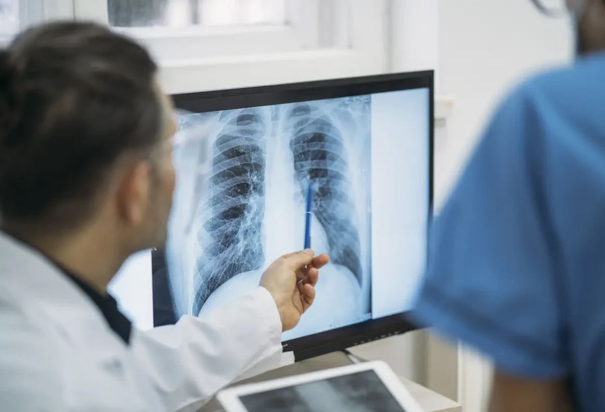 La detección precoz de una neumonía es vital para evitar complicaciones.