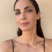 La top model ha mostrado su rostro justo después de sufrir el percance.