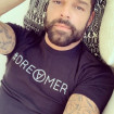 Ricky Martin, de 49 años, se habría sometido a un severo retoque estético.