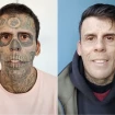 El hombre más tatuado del mundo antes y después.