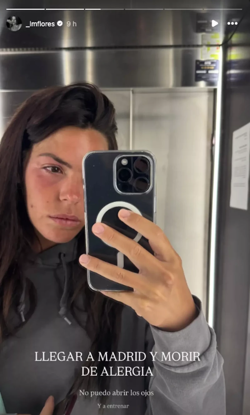 Laura Matamoros con la cara hinchada
