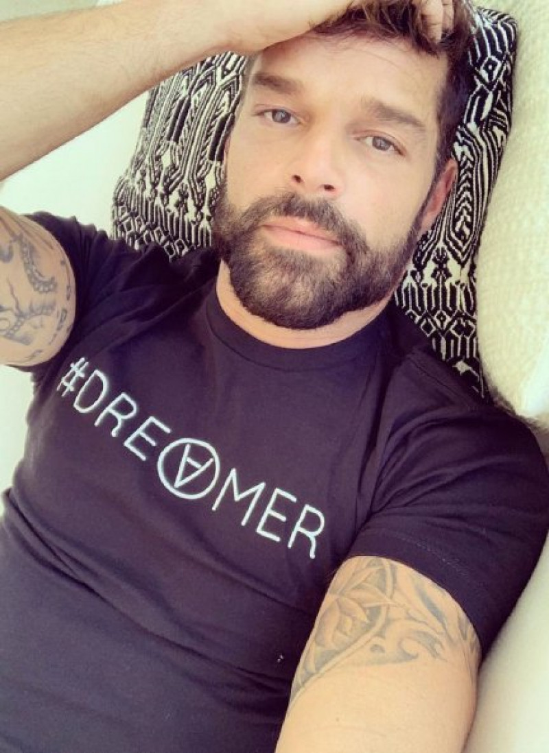 Ricky Martin, de 49 años, se habría sometido a un severo retoque estético.