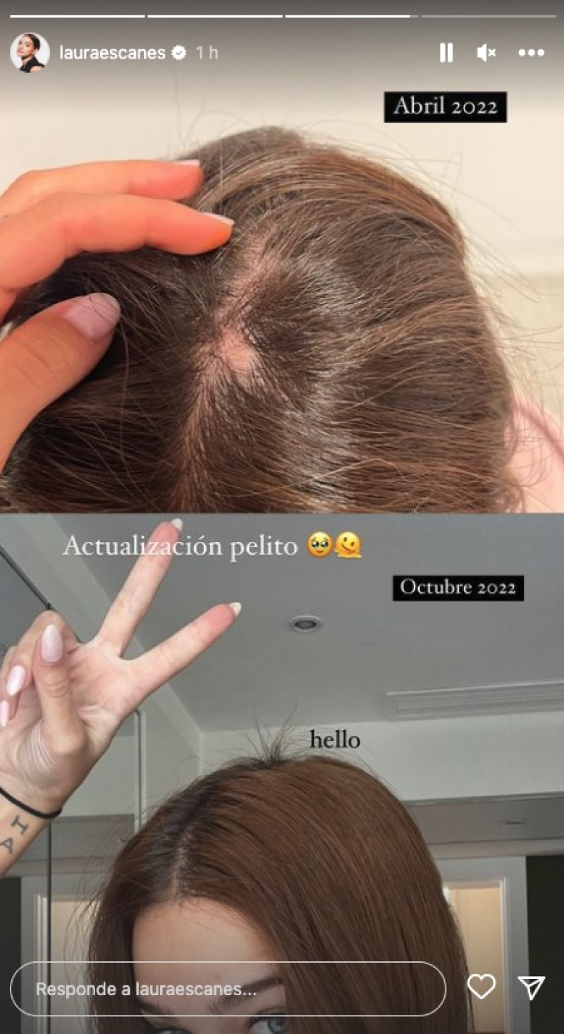Laura Escanes muestra la evolución de su pelo