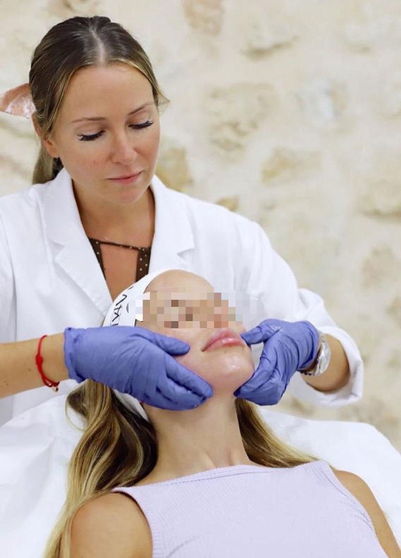 Novia de Joaquín Prat aplicando en la cara de una cliente un tratamiento de belleza.