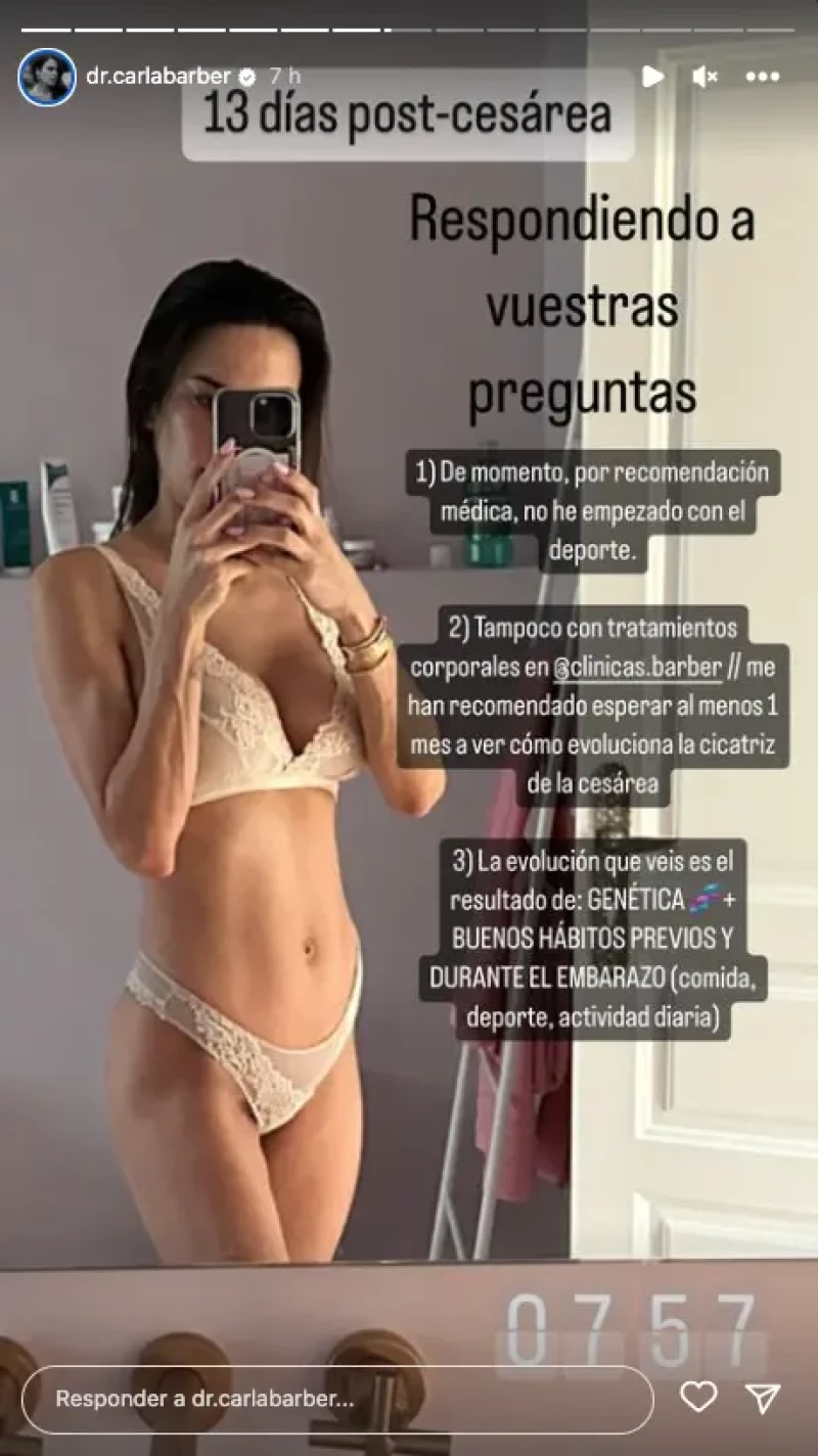 carla barber resultado cesaria 2 semanas bebe 1