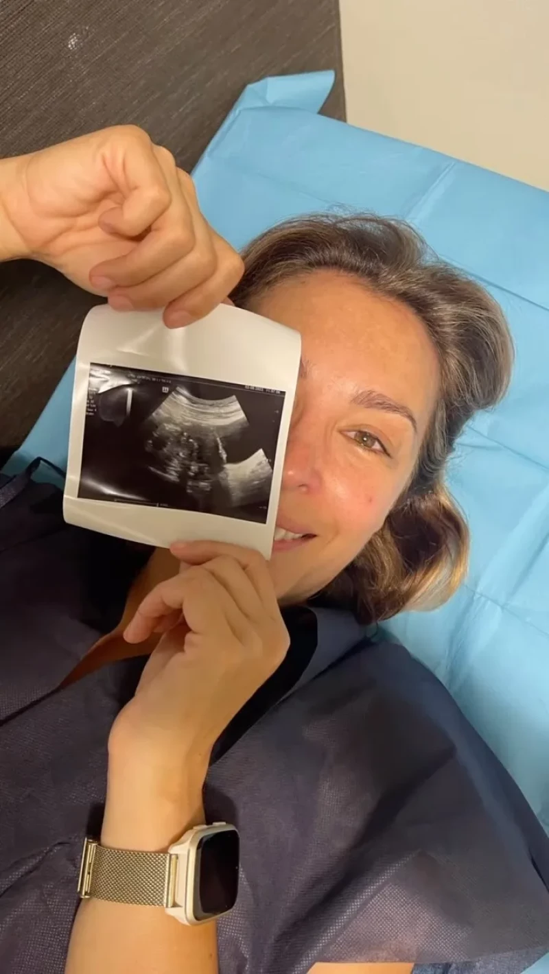 Gisela presume de la ecografía de su bebé.