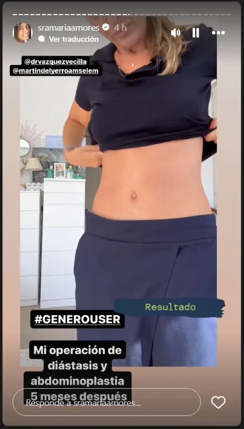 María Amores enseña el resultado de su operación de abdomen.