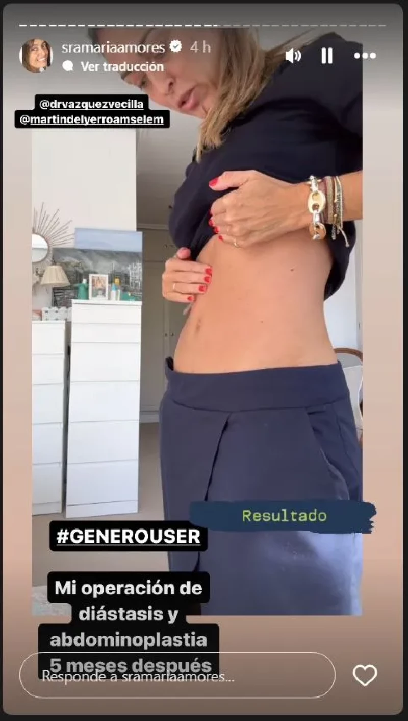 María Amores enseña el resultado de su operación de abdomen.