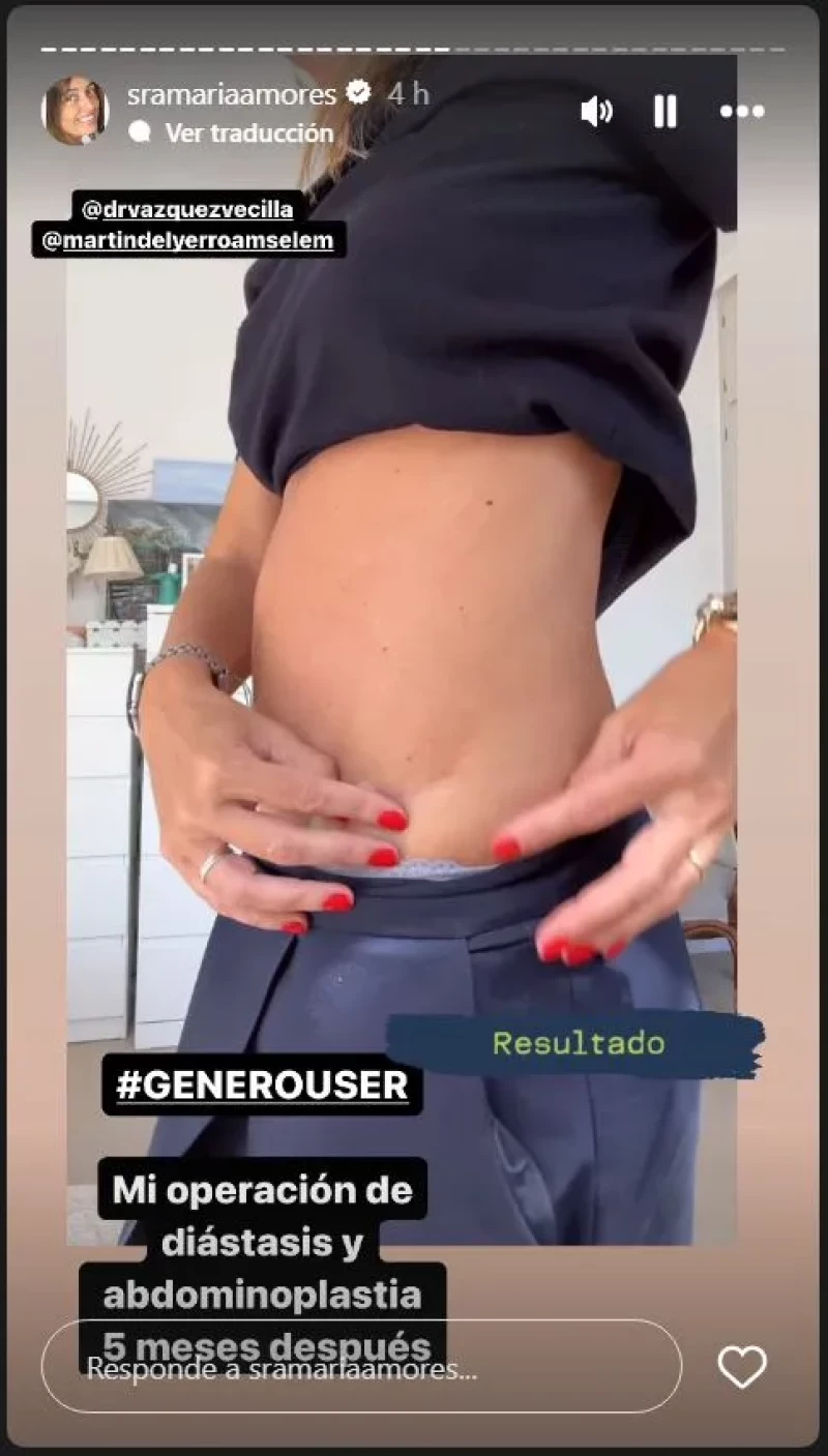 María Amores enseña el resultado de su operación de abdomen.