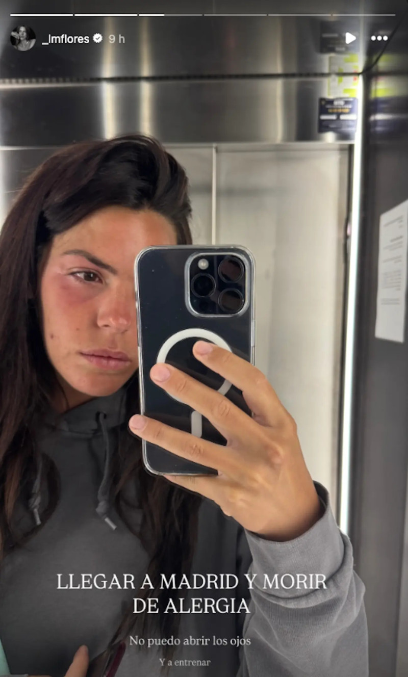 Laura Matamoros con la cara hinchada