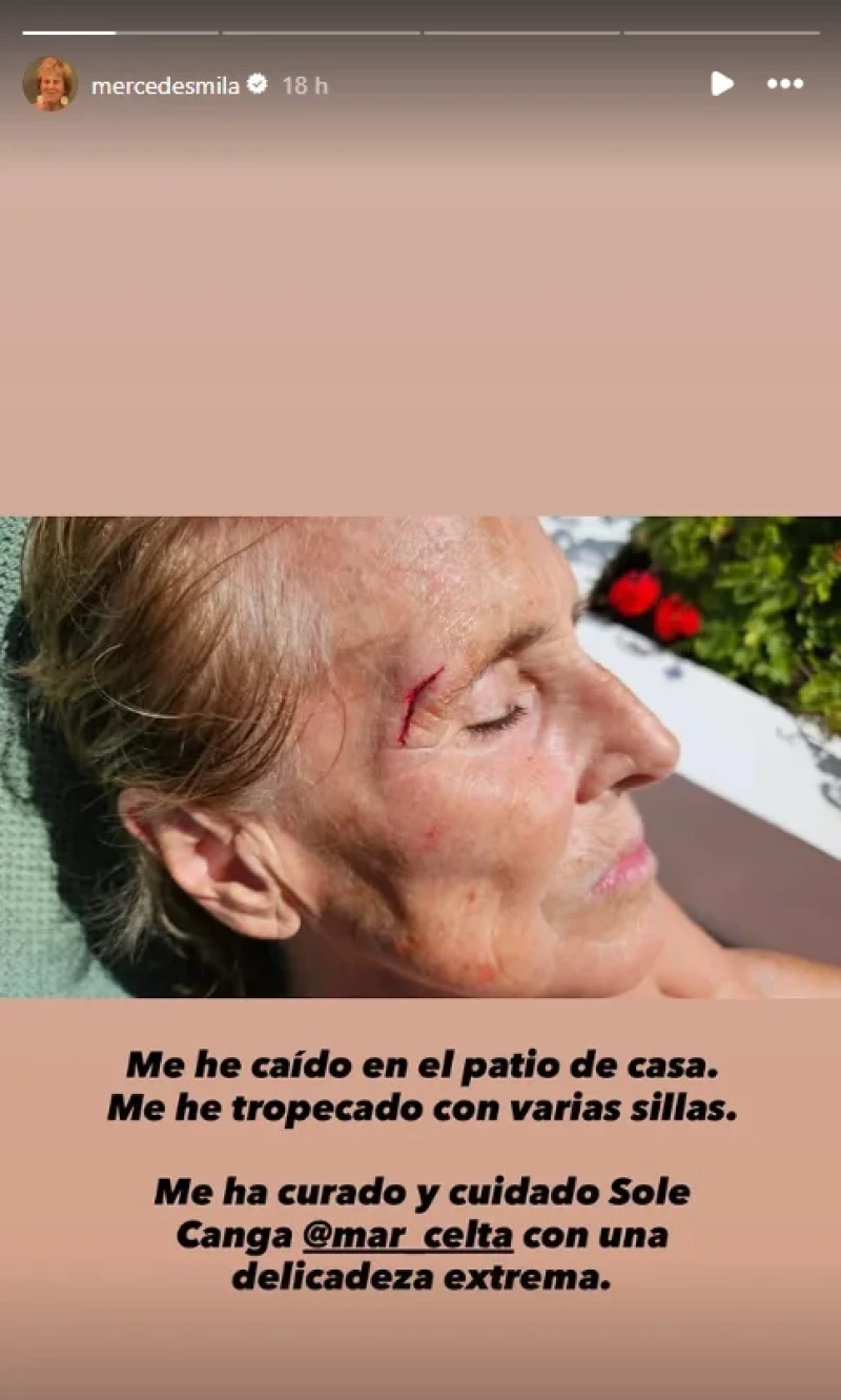 mercedes milá bien