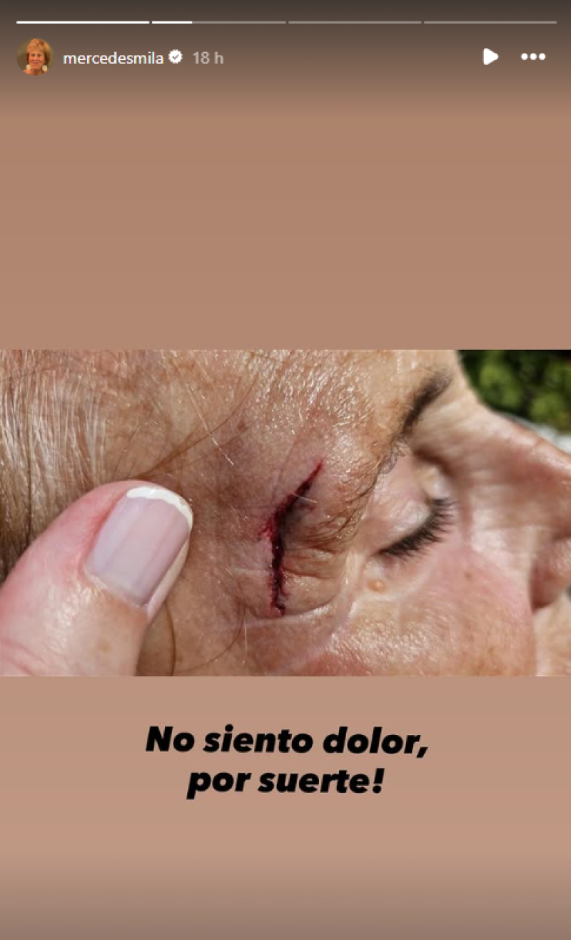 mercedes milá 1