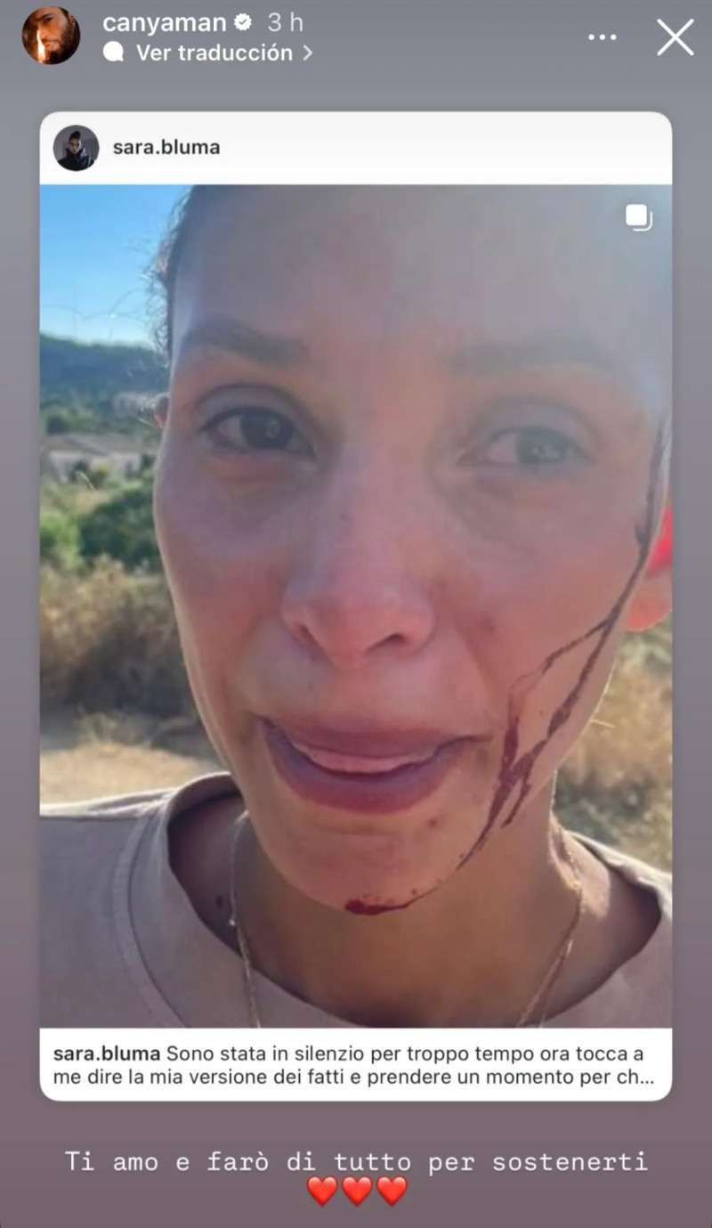 Redes sociales de Can Yaman apoyando a su pareja, Sara Bluma