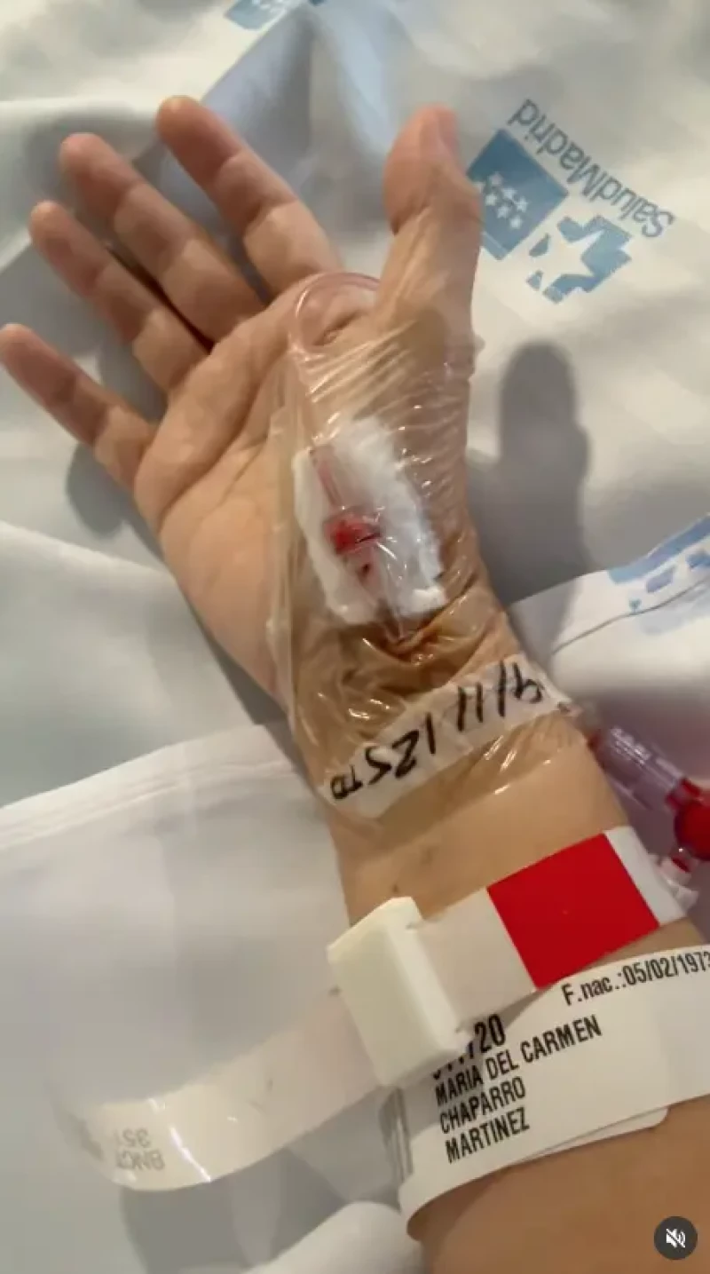 Carme chaparro operada dos veces