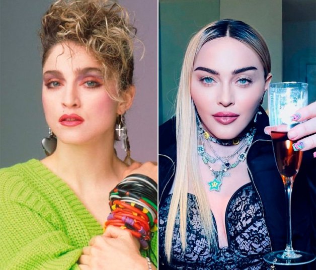 De "espeluznante" califican un reciente vídeo publicado por Madonna en el que se la ve sin filtro y tal cual ha quedado tras la infinidad de operaciones a las que se ha sometido.