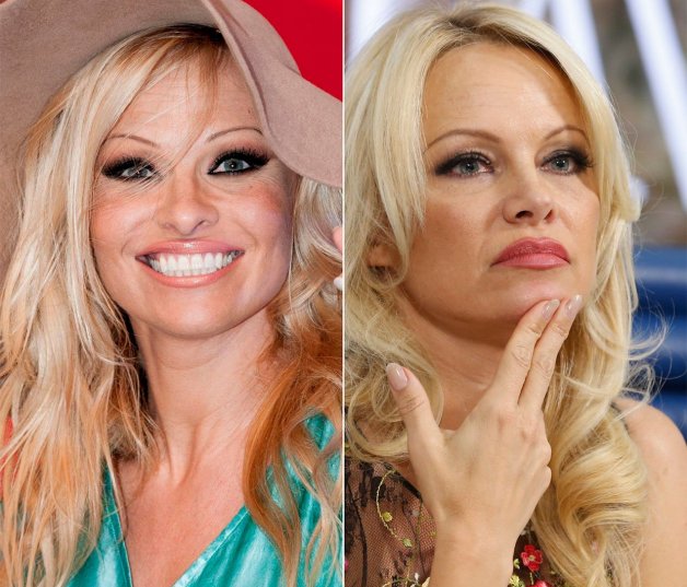 Pamela Anderson se operó la nariz y en 2017 se la vio muy cambiada.