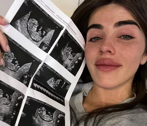 Violeta Mangriñán muestra, entre lágrimas, las primeras ecografías del bebé (@violeta_mangrinyan).