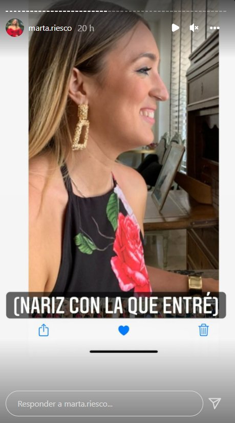 Marta Riesco antes de su retoque estético en la nariz (@marta.riesco).