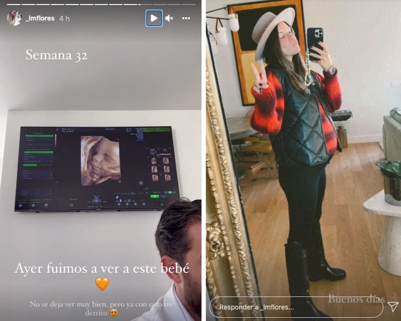 Laura comparte su última ecografía y su 'outfit' a sus 32 semanas de embarazo.