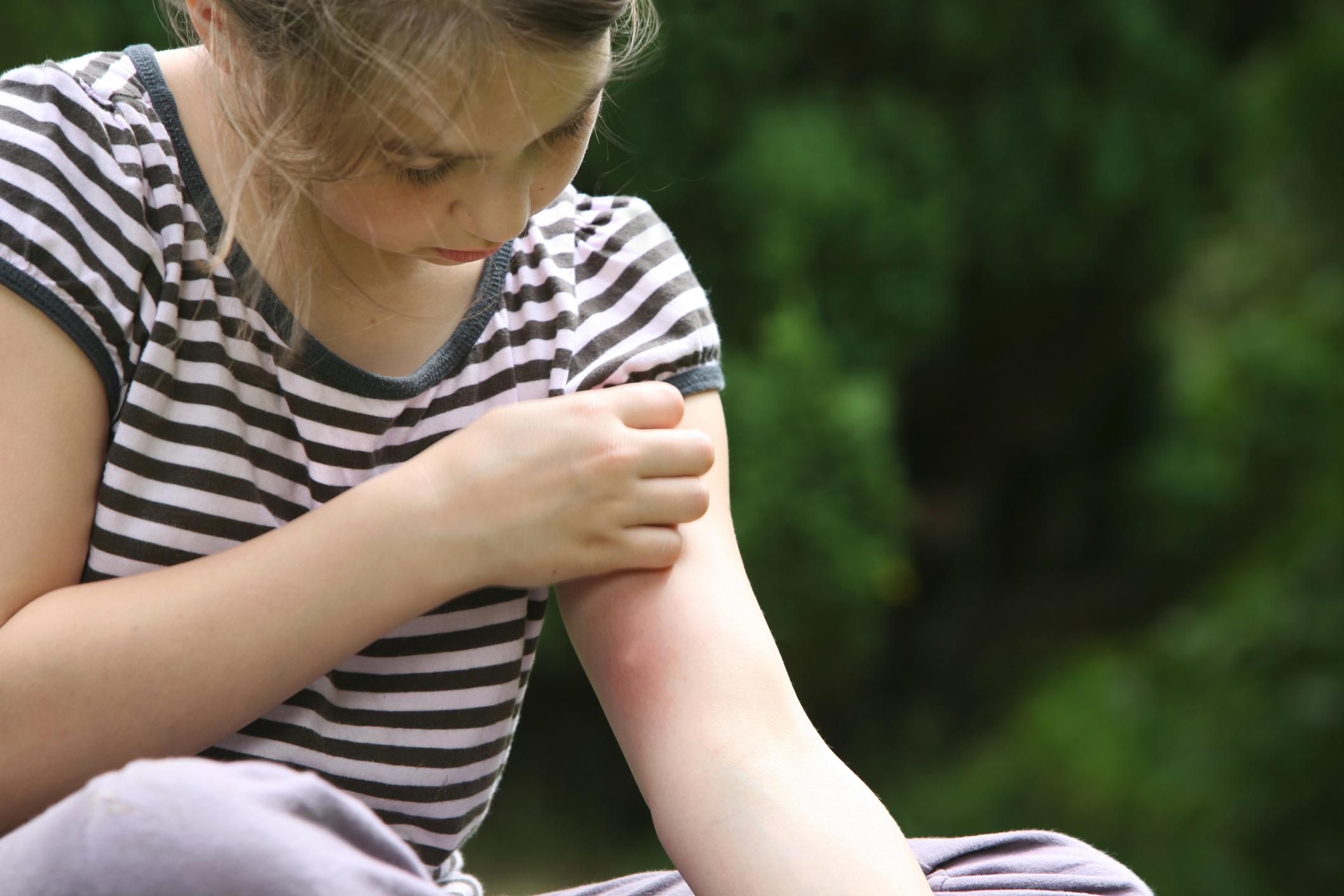 En verano, aumentan las actividades al aire libre y, con ello, la llegada de los mosquitos y demás insectos.