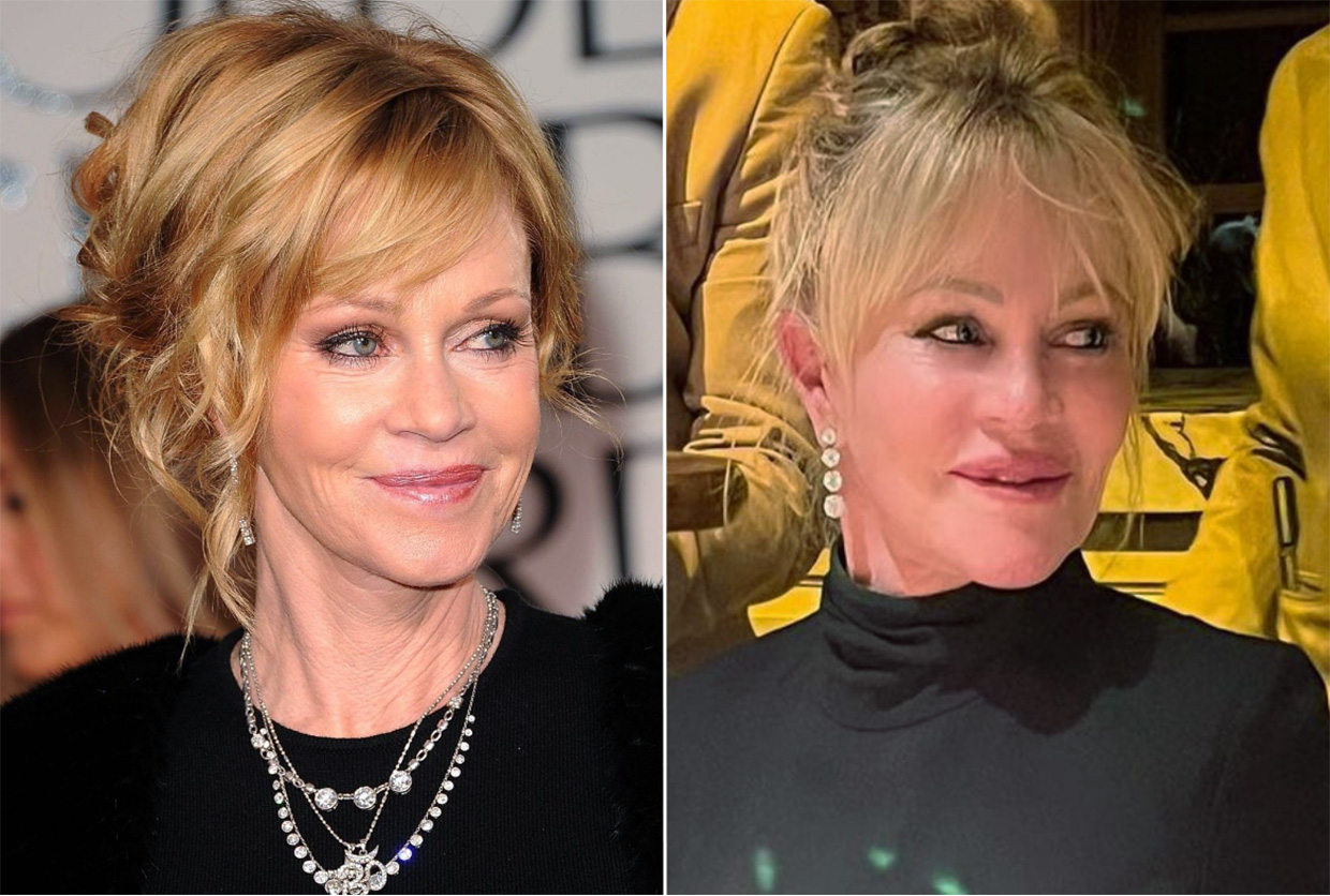 Melanie Griffith, el antes y el después de su cambio.