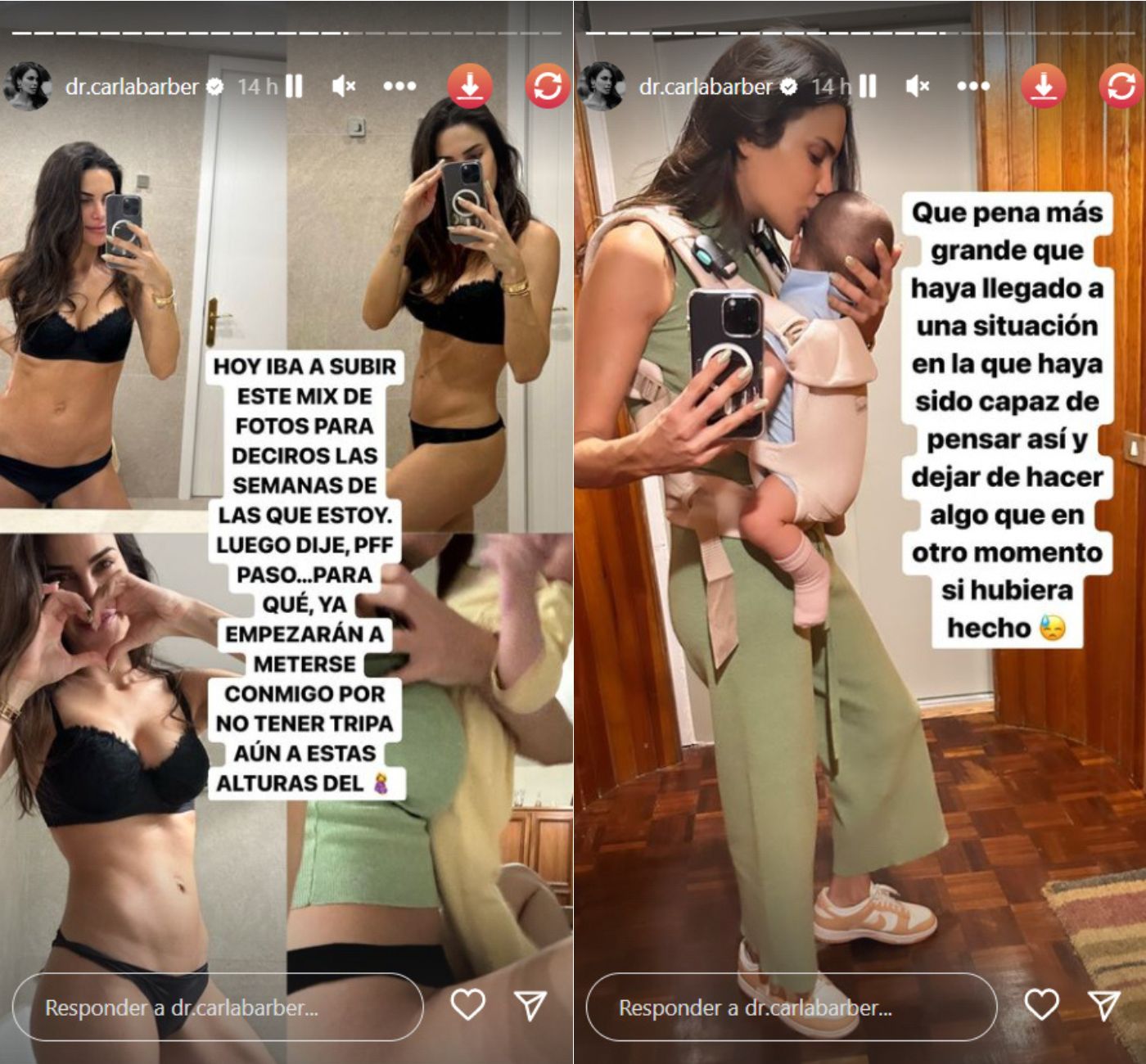 Carla Barber en sus historias de Instagram (@dr.carlabarber)