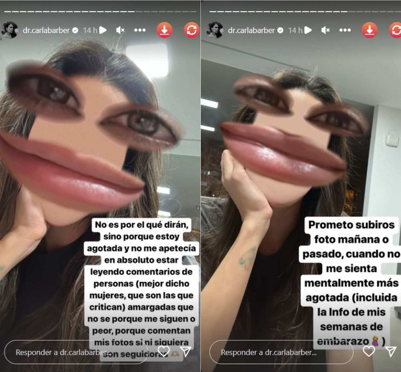 Carla Barber en sus historias de Instagram (@dr.carlabarber)