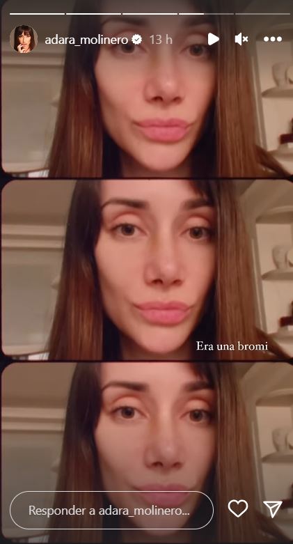 Adara enseña el su nueva nariz en stories.