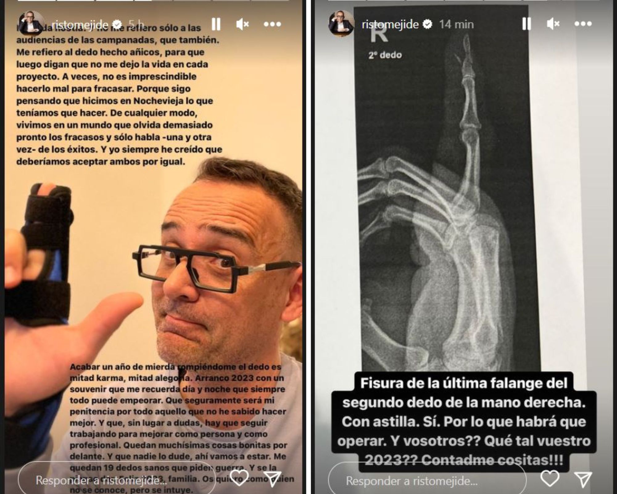 Risto Mejide se ha roto un dedo.
