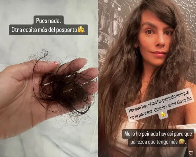 cristina pedroche caída pelo parto 1