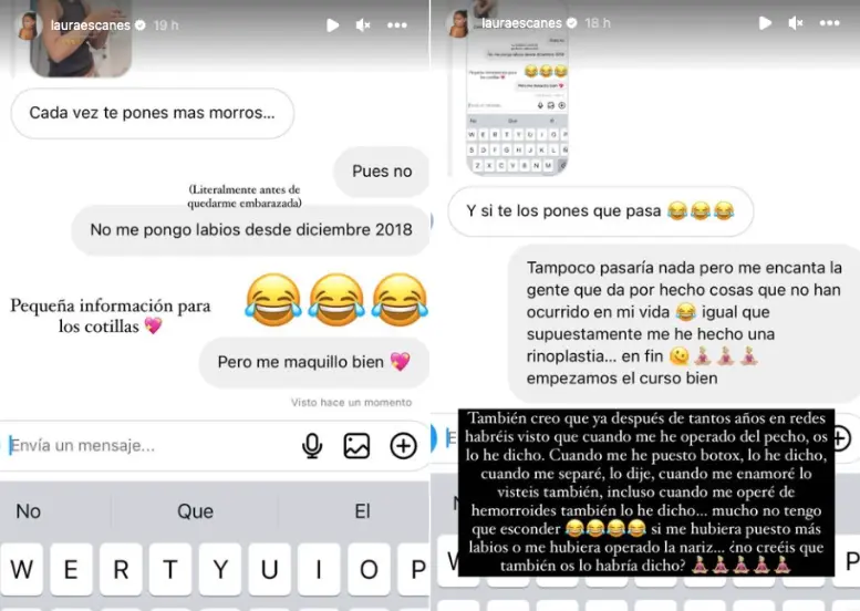 laura escanes confiesa retoques estéticos 1