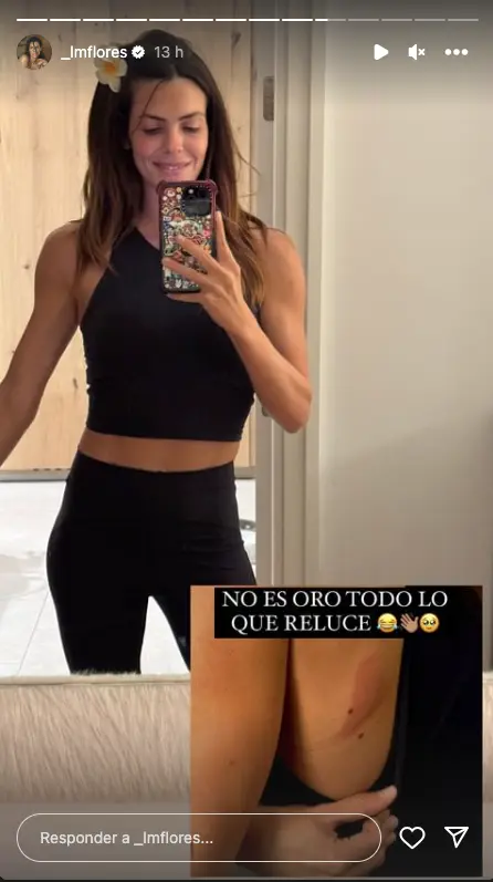 Laura Matamoros enseña la rozadura que se ha hecho tras caerse en la cinta