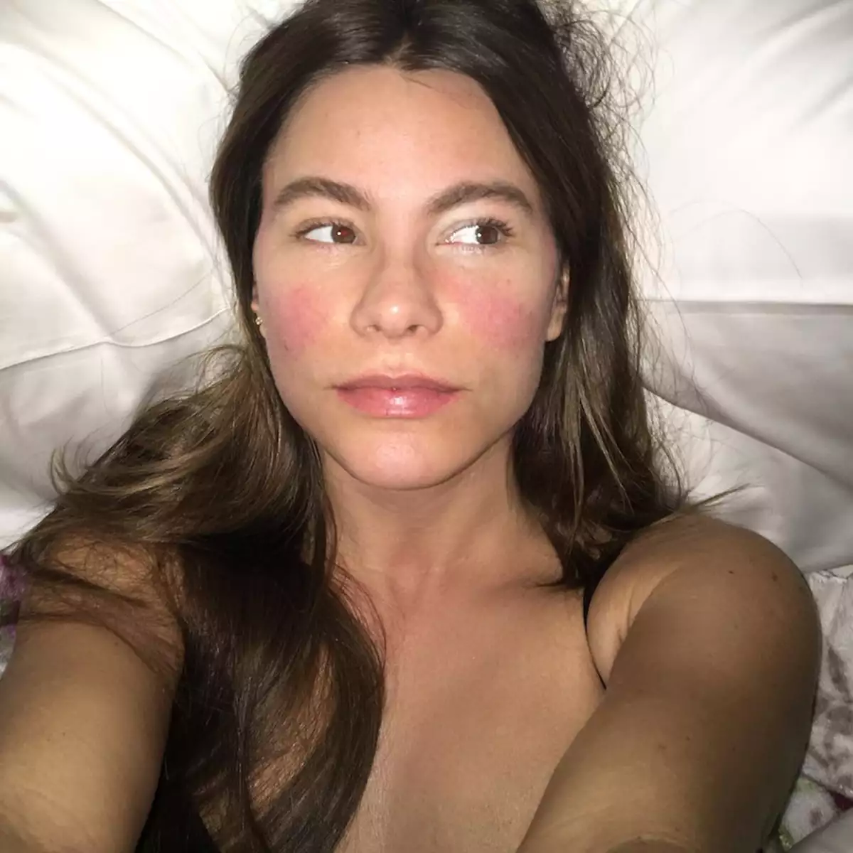 Sofia Vergara en una imagen donde se puede ver que tiene rosácea en el rostro