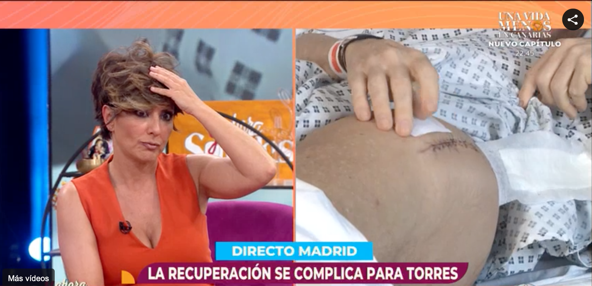 Joaquín Torres muestra la cicatriz de su operación
