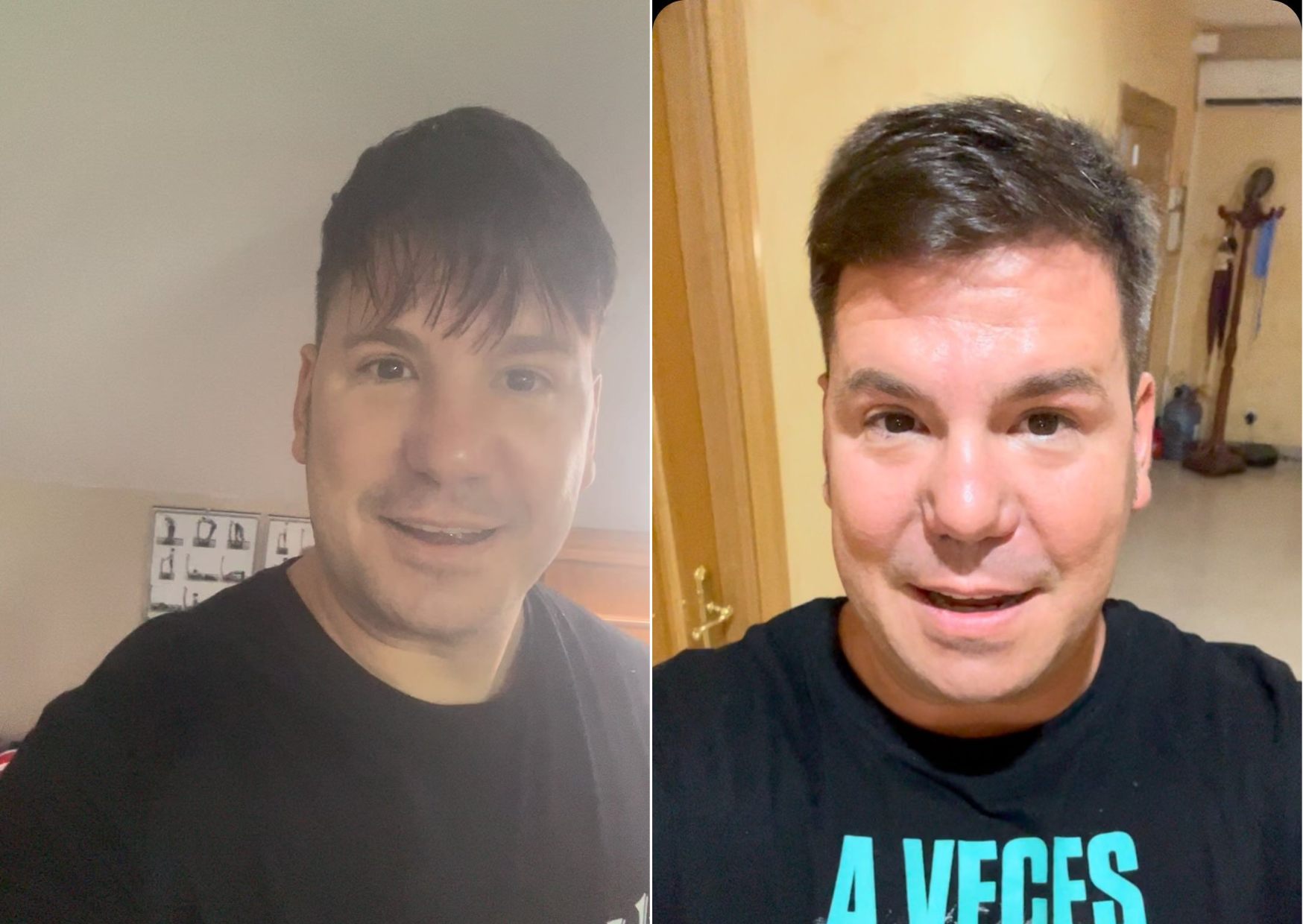 El antes y después de Lucas gonzález.