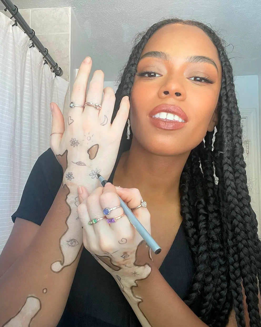 Chica con vitiligo en las manos que se ha hecho unos dibujos en la piel