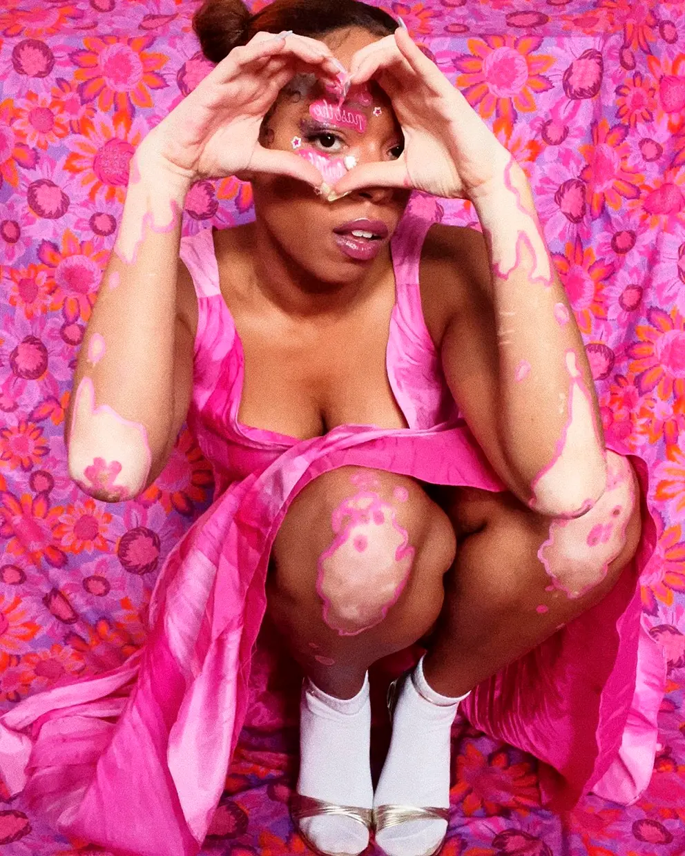 Chica con vitiligo en su cuerpo posando en culillas con un vestido rosa y pintura rosa decorando su piel