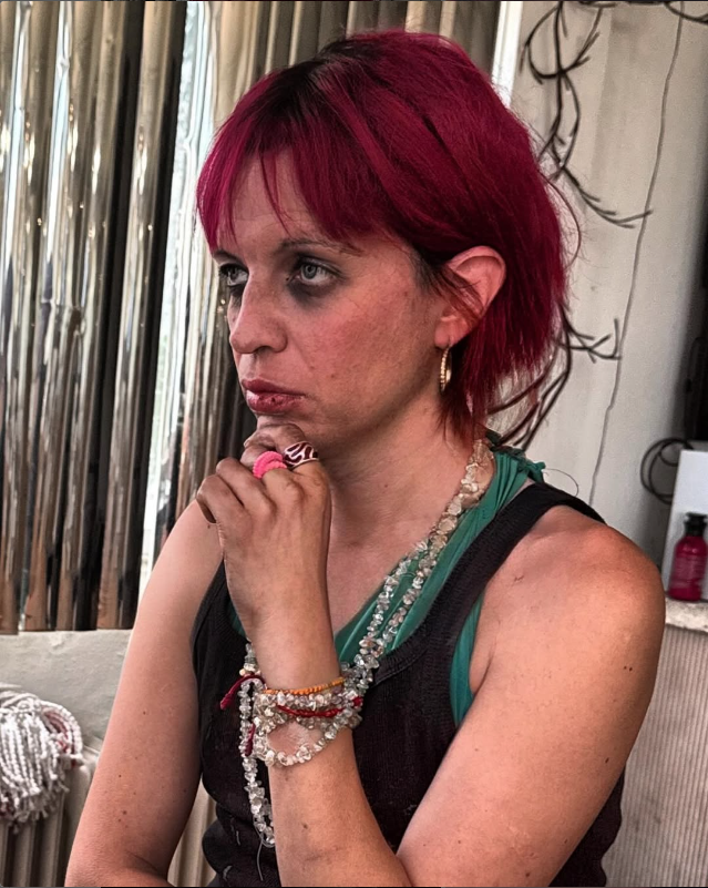 Sheila Devil, más desmejorada que nunca: sus preocupantes nuevas fotos