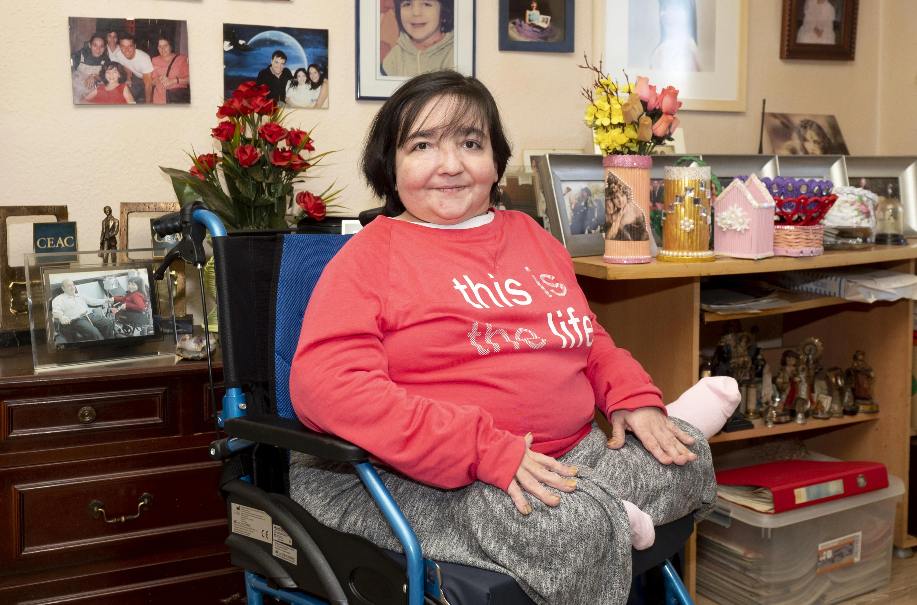 Vanessa Jiménez, la "niña de los huesos de cristal".