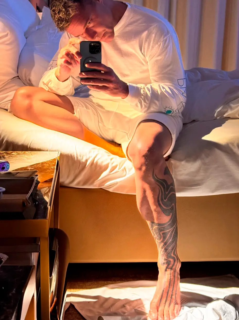 Ricky Martin mostrando su pierna