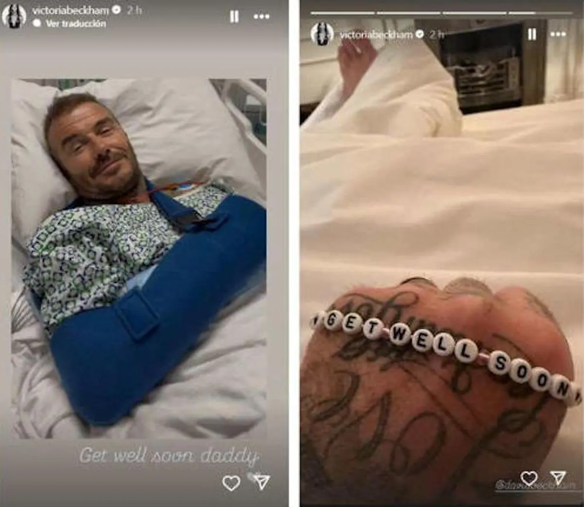 David Beckham operado