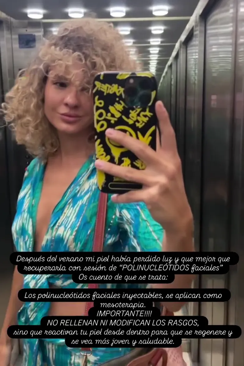 Sheila Casas se ha hecho un retoque estético.